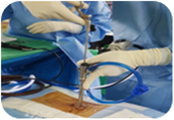 Uniportal Full Endoscopic Spine